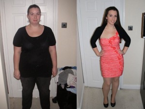 Claire gastric sleeve